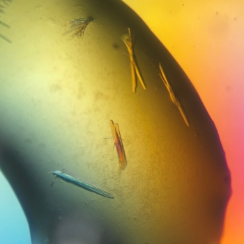 Yellowy crystal drug as seen under a microscope