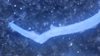 Close up view of a rat femoral aorta, which looks like a white tubular pathway across the horizontal middle of the photo