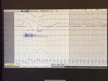 An electronic version of a sleep study file with the same squiggles but within the window of a computer application instead of paper