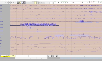 Screenshot of a sleep scoring file with lots of squiggly line sleep patterns