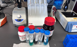 studying a phosphatase enzyme in Tuberculosis