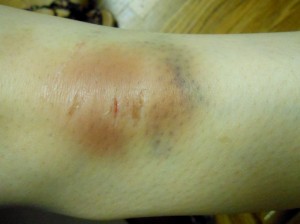 In memory of my very first fall in the marshes.