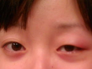 I think I look like Quasimodo in the  in the The Hunchback of Notre-Dame.