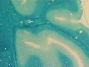 LUXOL FAST BLUE 2 and resaved