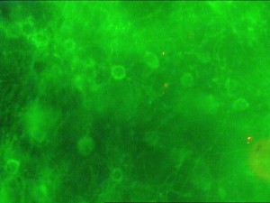 STAINS OF OLIGO 2 (3)