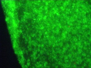 STAINS OF OLIGO 3 (3)