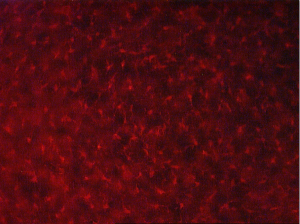 red microglia